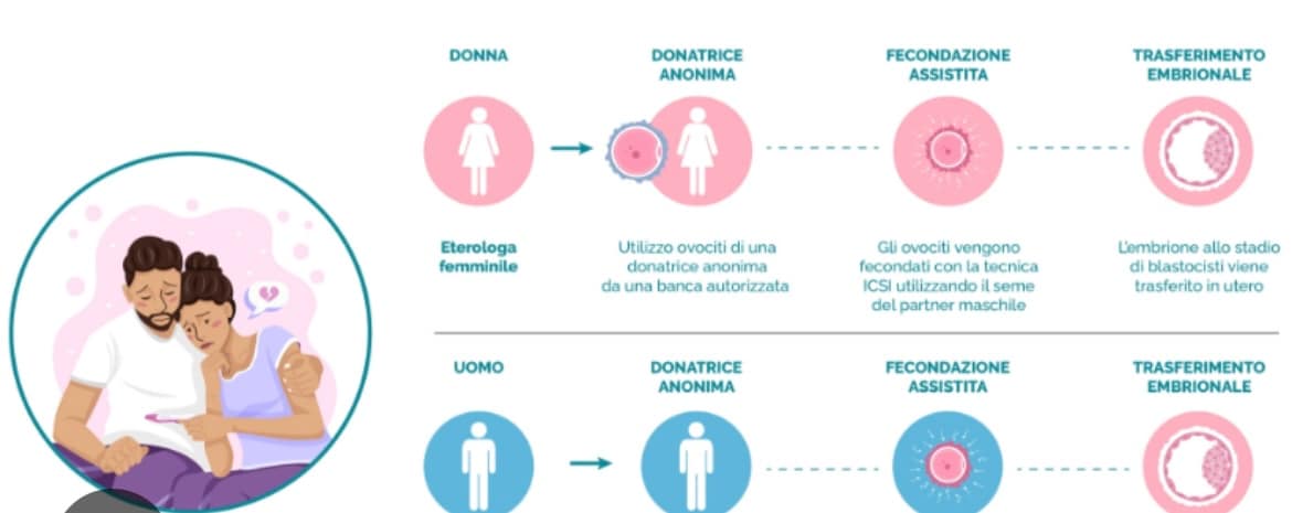 Al momento stai visualizzando Legittimo il divieto della donna single di accesso alle tecniche di PMA